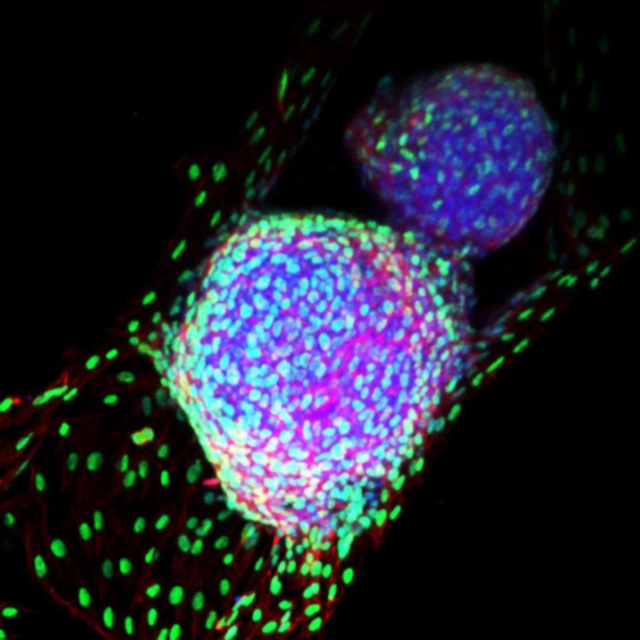 Micrograph of a bioprosthetic ovary.