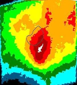 Thermal Image of Karposi's sarcoma.