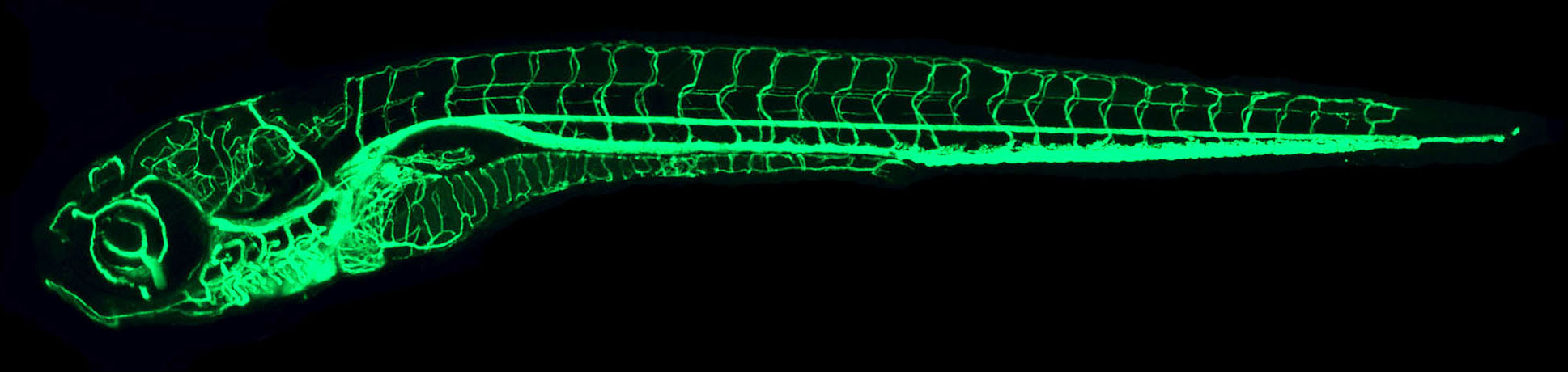 The confocal microangiography of a zebrafish larva.