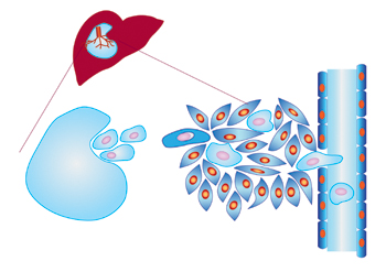 A diagram illustrating cancer cells spreading in the bloodstream.