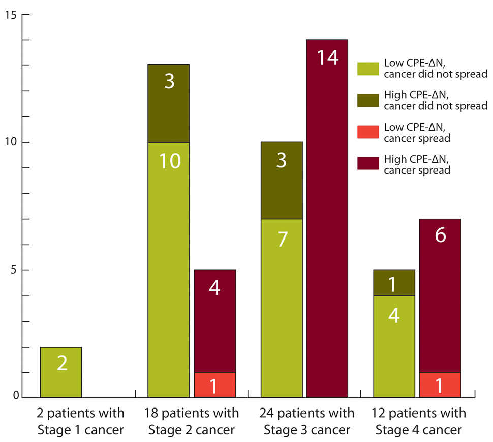 Bar chart with four bar colors:  Light green bar (Low CPE-delta N – cancer did not spread).  Dark green bar (High CPE-delta N – cancer did not spread).  Light red bar (Low CPE-delta N – cancer spread).  Dark red bar (High CPE-delta N – cancer spread).  The bar chart has four sections:  2 patients with State 1 cancer – light green bar of 2 units.  18 patients with Stage 2 cancer – light green bar of 10 units, dark green bar of 3 units, light red bar of 1 unit, and dark red bar of 4 units.  24 patients with Stage 3 cancer – light green bar of 7 units, dark green bar of 3 units, and dark red bar of 14 units.  12 patients with Stage 4 cancer – light green bar of 4 units, dark green bar of 1 units, light red bar of 1 unit, and dark red bar of 6 units.