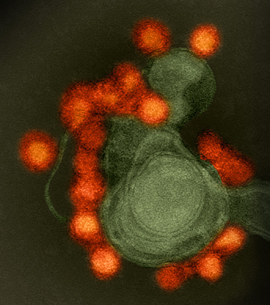 electron micrograph, Zika virus