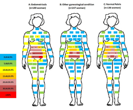 Diagram of bodily areas where women reported feeling pain.