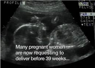 Sonogram with text "Many pregnant women are now requesting to deliver before 39 weeks..."
