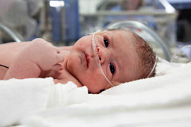 A newborn baby with breathing tubes in her incubator in NICU.