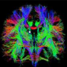 brain imaging