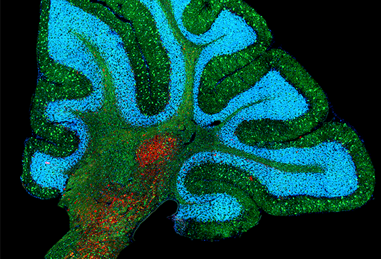 Microscopy image of brain tissue. Credit: NICHD