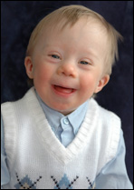 Child with Down Syndrome