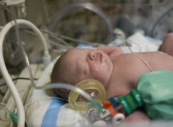 Baby in an incubator 